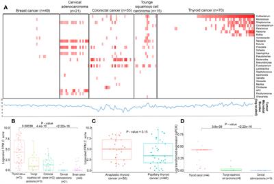 Association of Cutibacterium acnes with human thyroid cancer